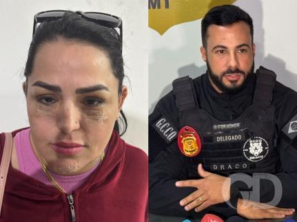 Angeliquinha fez mais de 5 procedimentos estéticos e usava documento falso na Bolívia